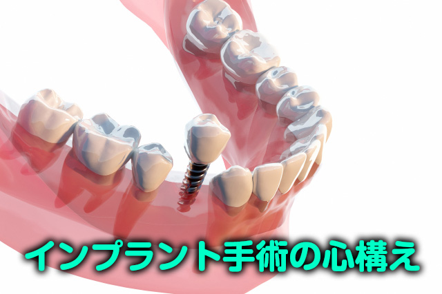 インプラント手術の心構えメインビジュアル
